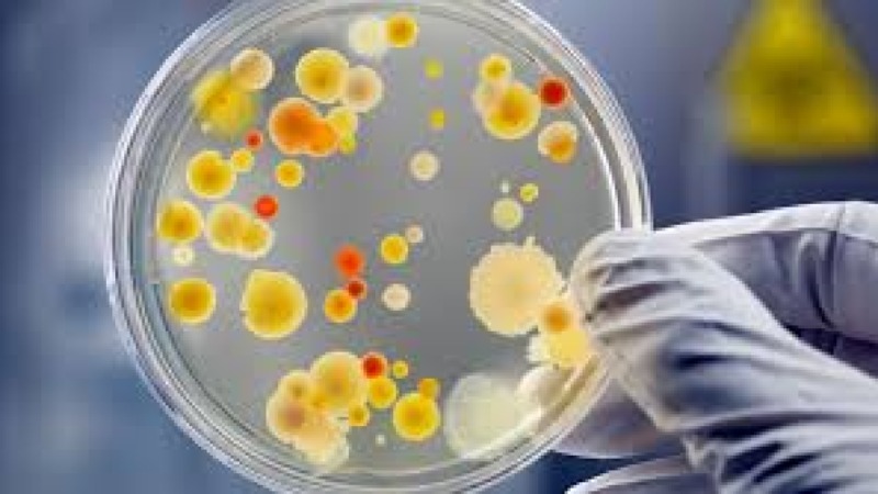 Principles of Food Microbiology for Non-Microbiologists Training Course